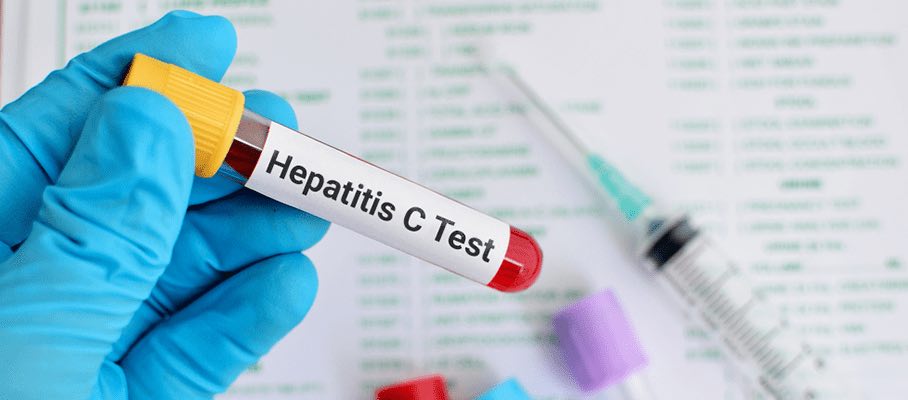 Diagnosticarea hepatitei C mai accesibilă prin utilizarea unui test rapid de diagnosticare (VHC) în spital