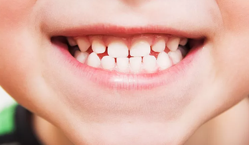Cercetătorii au dezvoltat un medicament inovator care stimulează creșterea dinților 