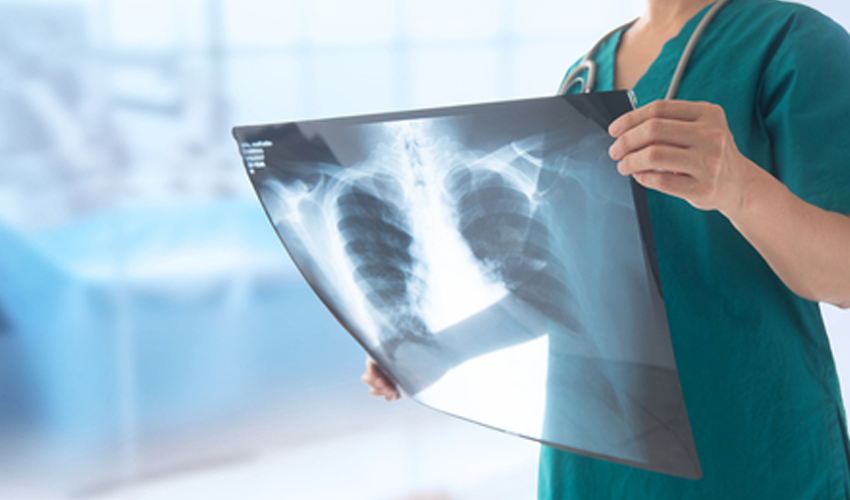  Tuberculoza, o problemă de sănătate publică. Cine este cel mai expus riscului