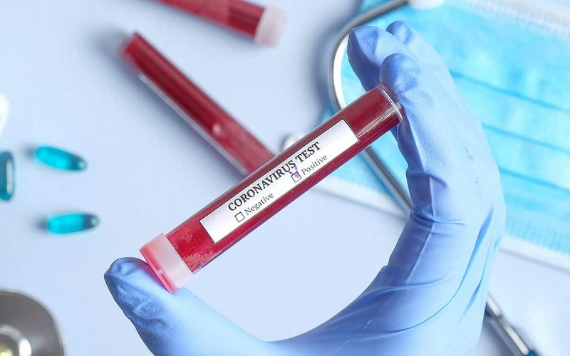 Încă 195 de cazuri de Covid-19, confirmate